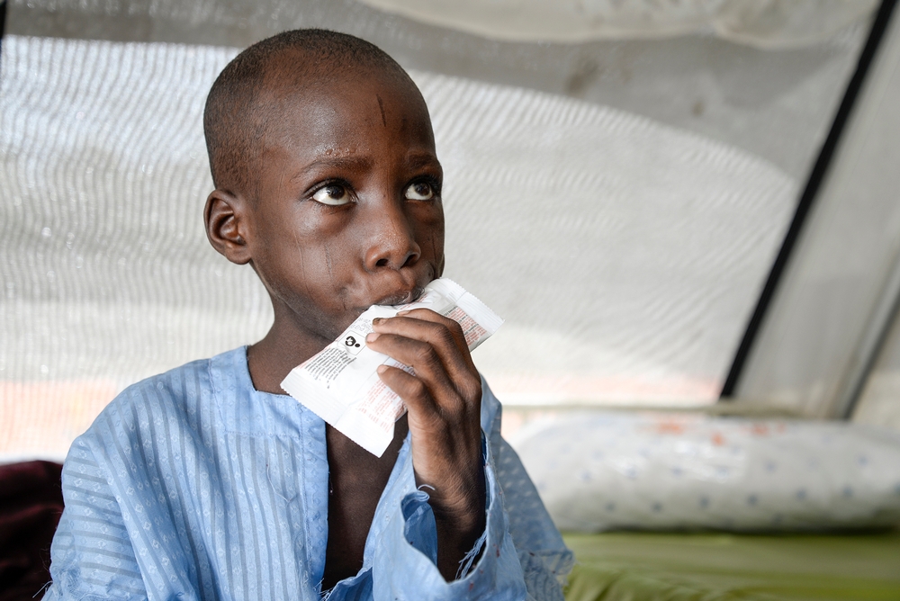 Un enfant de huit ans souffrant de malnutrition sévère aiguë. Il a été hospitalisé au centre de traitement de Gwange  