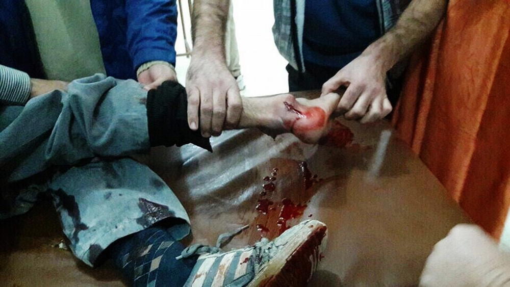 Sept personnes sont tuées et 47 blessées lors d'une redoutable attaque "double tap" contre un hôpital de Homs. © MSF Novembre 2015. 
