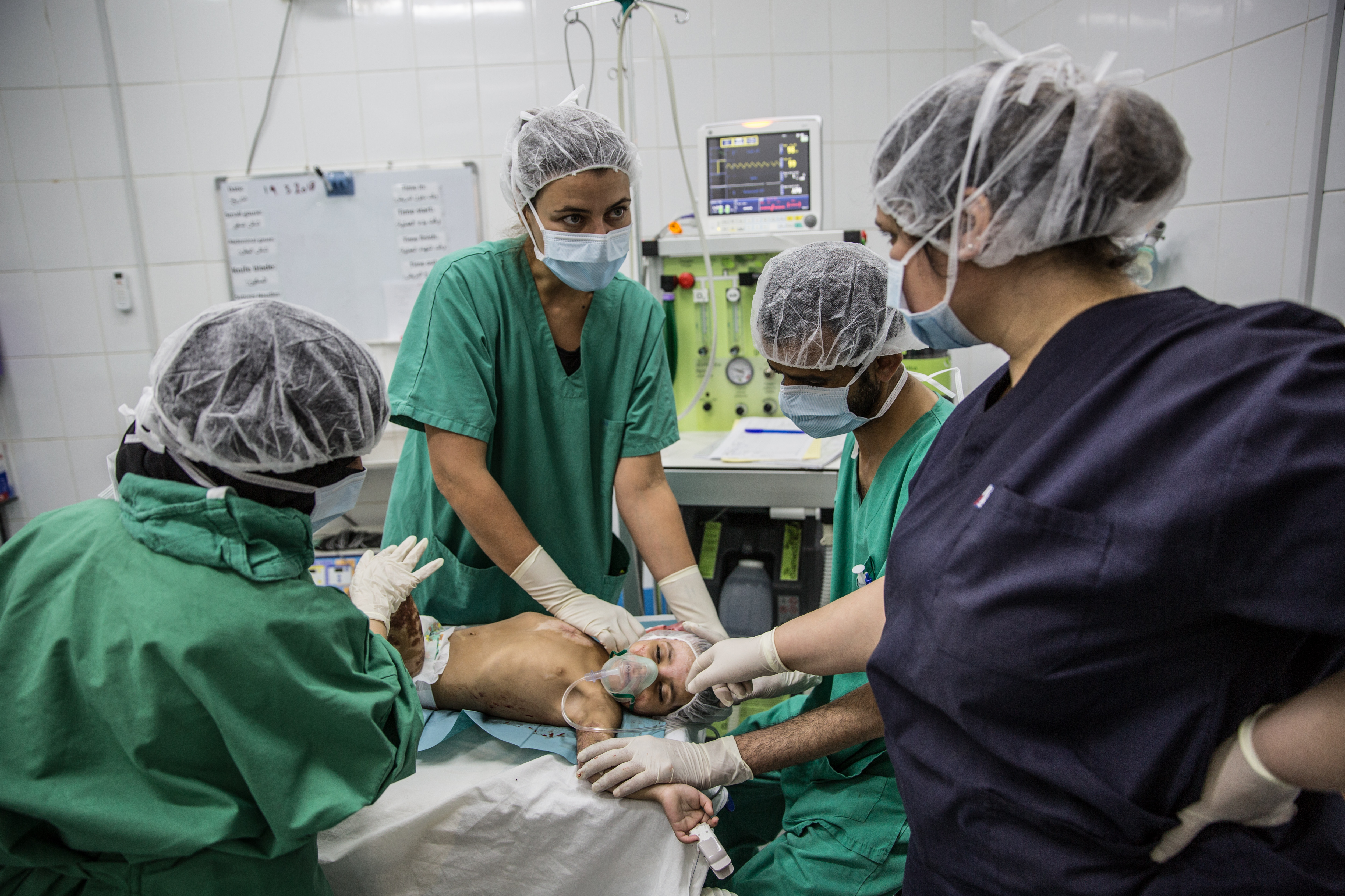 Elizabeth Braga, kinésithérapeute chez MSF, fait une intervention sur une enfant brulée pour l'aider à récupérer de la mobilité au niveau de son bras droit. © Agnes Varraine-Leca, 20 mars 2018